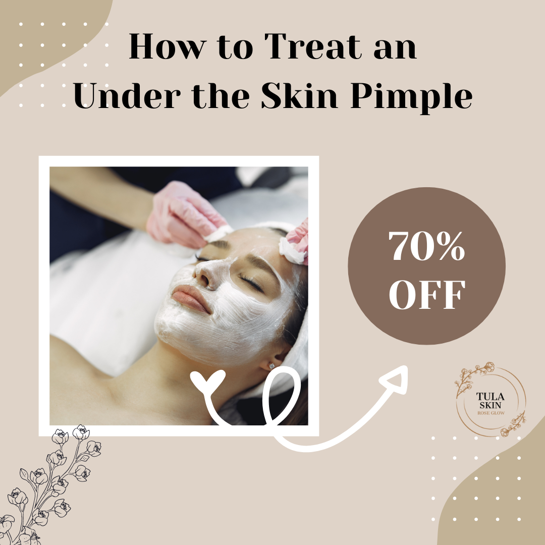 How to Treat an Under the Skin Pimple