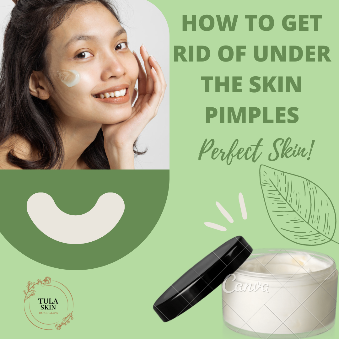 How to Get Rid of Under the Skin Pimples