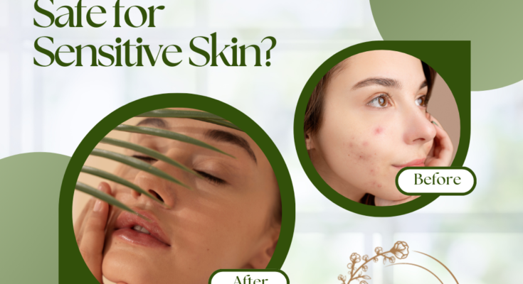 Are Obagi Skin Care Products Safe for Sensitive Skin